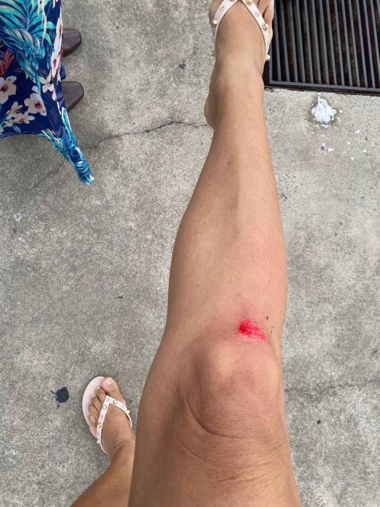 Pedestre cai em galeria aberta na calçada em frente ao CREA-MA na avenida dos holandeses e fica ferida