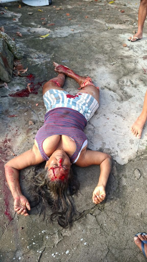Mulher é atropelada por carro desgovernado após veículo descer sozinho na Avenida do Mangue Seco
